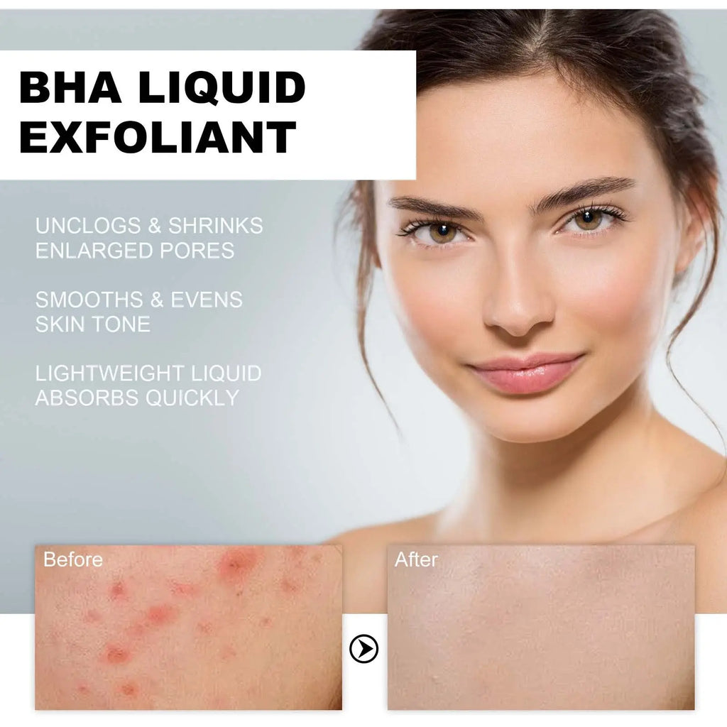 BHA Liquid Exfoliant, Lightening Acne Seal Pore-Tightening And Moisturizing Skin Essence V.I.P Digital Presence