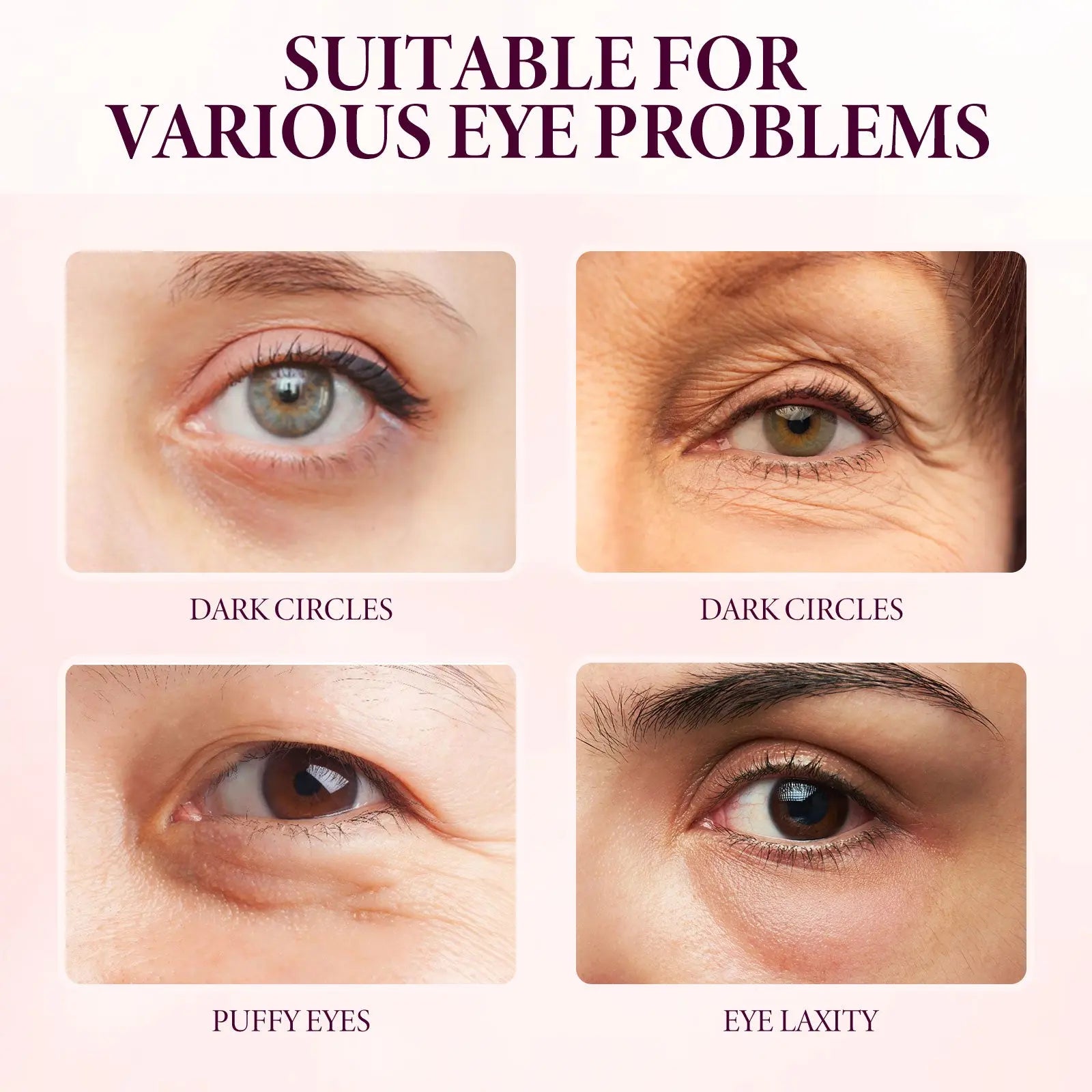 Mango Eye Cream Reduces Fine Lines Of Crow's Feet Bags And Gently Nourishes Elasticity And Tightens The Skin Around Eyes V.I.P Digital Presence