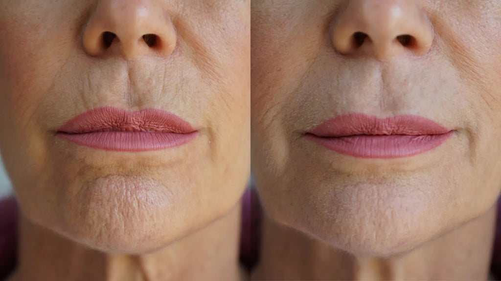 Ageless Lip & Line Filler PRAI Beauty