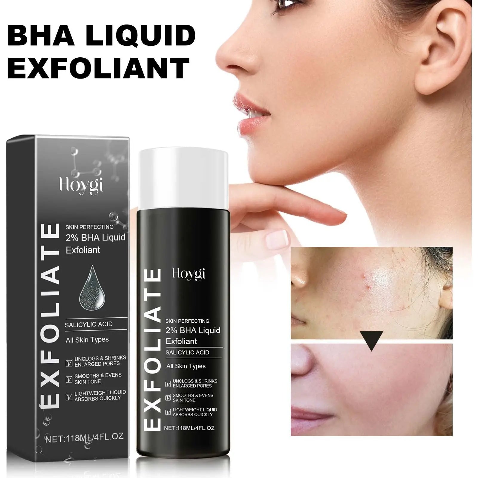 BHA Liquid Exfoliant, Lightening Acne Seal Pore-Tightening And Moisturizing Skin Essence V.I.P Digital Presence