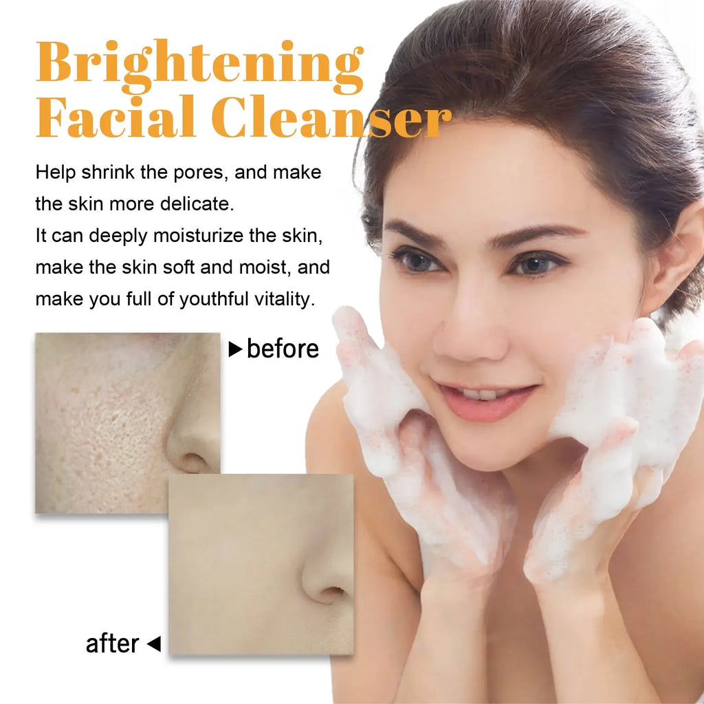 Brightening Facial Cleanser, Deep Clean Facial Skin Fade Acne Mark Acne Mark Moisturizing Whitening Beauty V.I.P Digital Presence