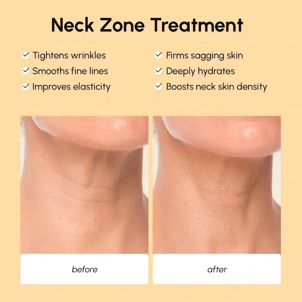 Lifting Neck Wrinkle Patches Maree