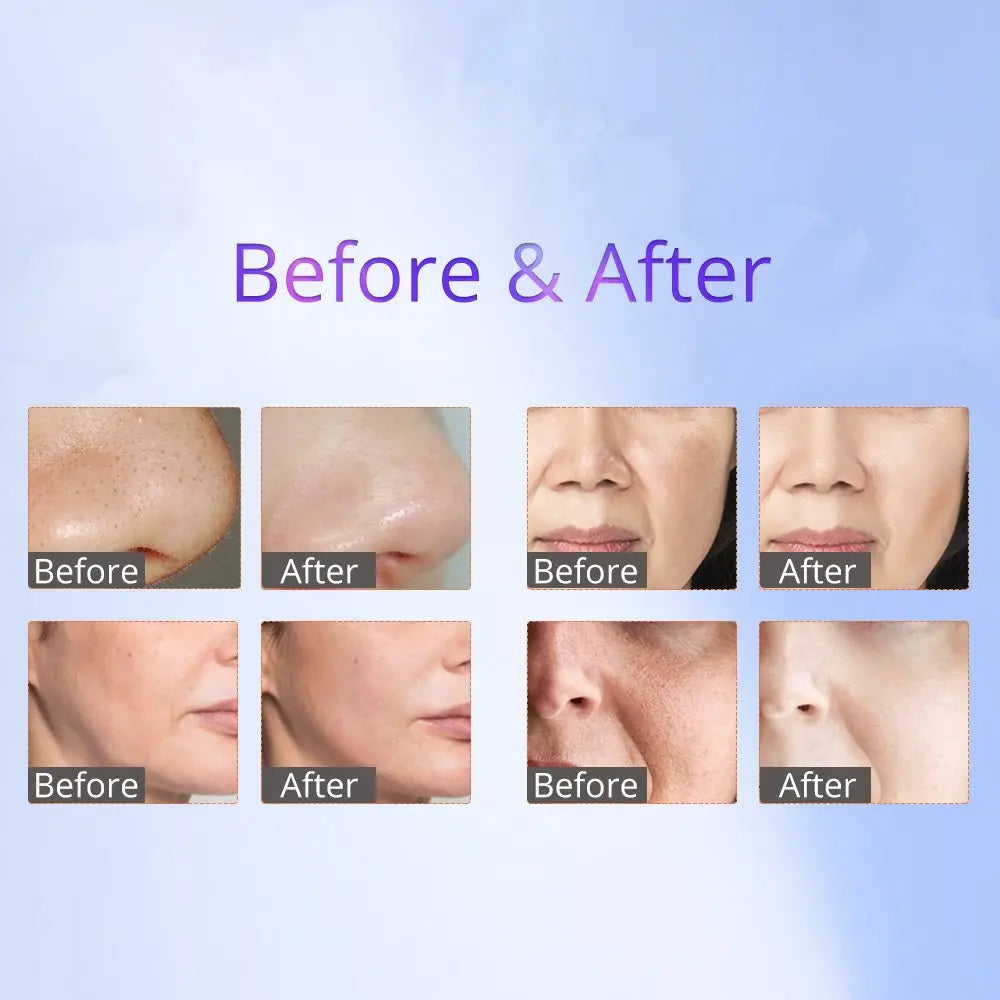 Shape Tactics 8-in-1 RF Skin Tightening System with Hot & Cold Hammer and BIO Therapy Cavitation Machines